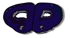 Coronal Section Rat Brain