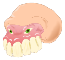 Dental Thumbnail