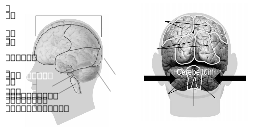 58294main_The.Brain.in.Space-page-34-brain-model