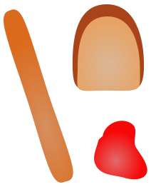 Frankfurter